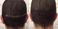 Novoscalp Micropigmentation Clinic image 6